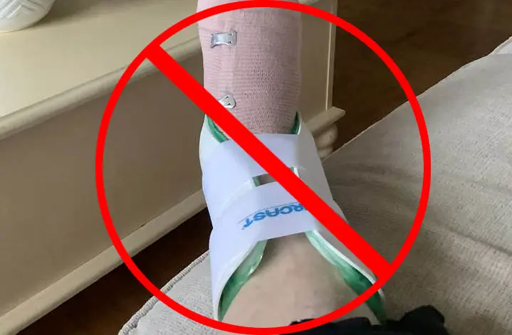 Sprained Ankle with Immobilizer